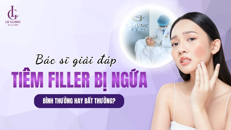 tiêm filler bị ngứa