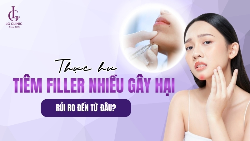 tiêm filler nhiều lần có sao không