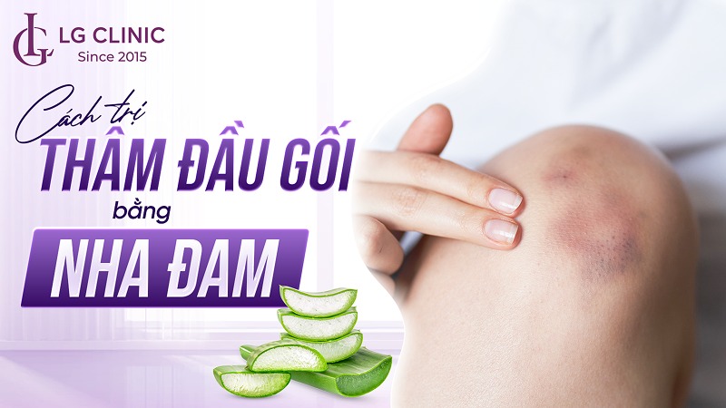 cách trị thâm đầu gối bằng nha đam