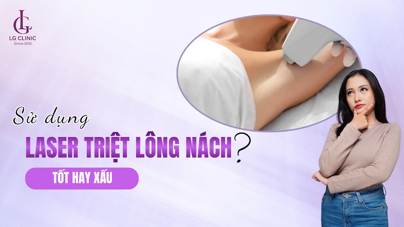 triệt lông nách bằng tia laser