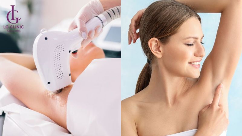 Triệt lông nách có ảnh hưởng gì không