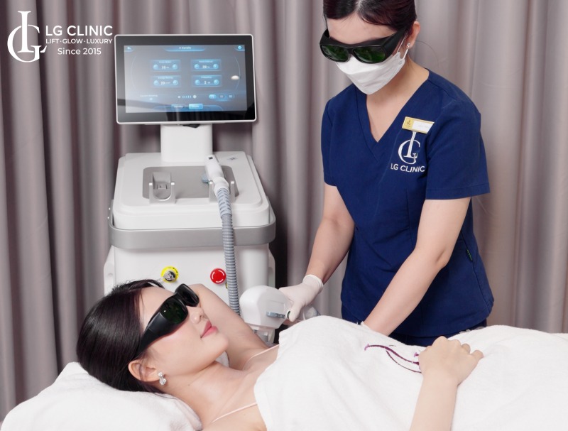 bảng giá triệt lông nách