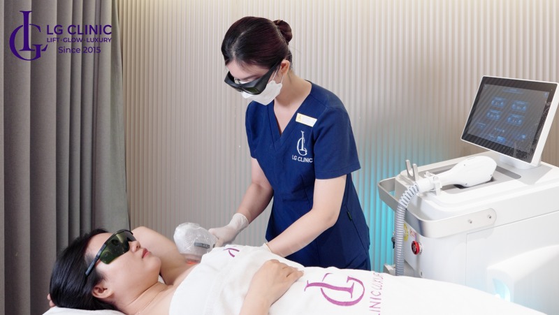 bảng giá triệt lông nách