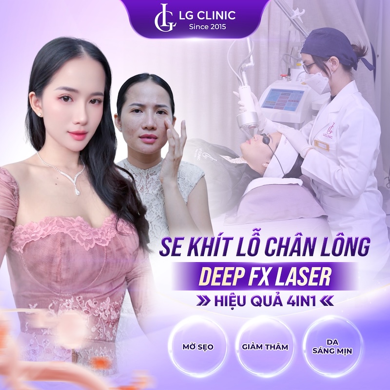 thu nhỏ lỗ chân lông deep fx laser