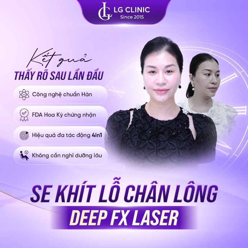 ưu điểm của deep fx laser