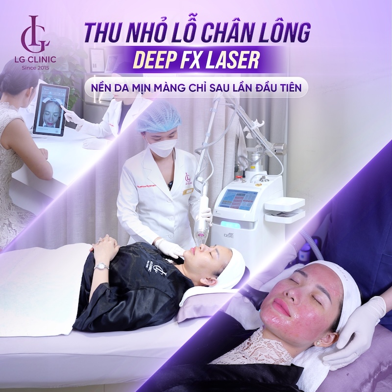 quy trình điều trị thu nhỏ lỗ chân lông