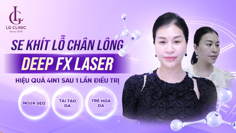 thu nhỏ lỗ chân lông deep fx laser