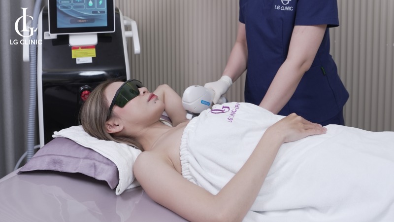 Hình ảnh triệt lông nách bằng công nghệ LG Cool Hybrid tại LG Clinic