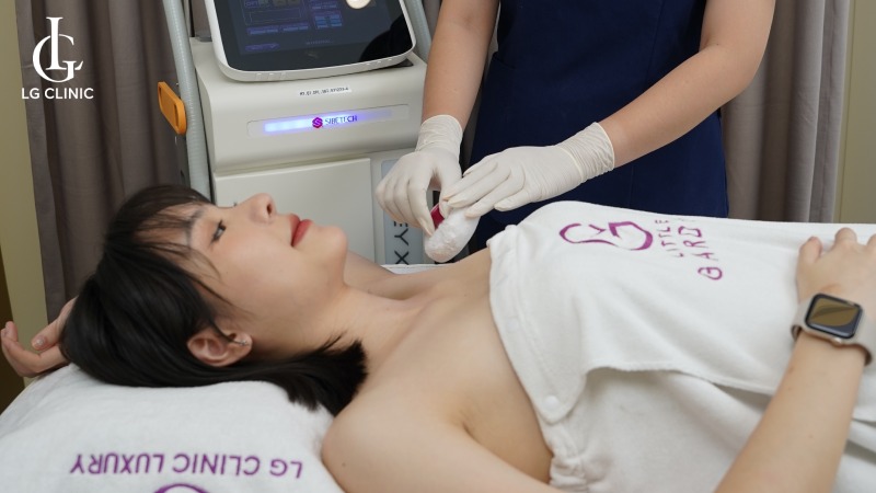 Hình ảnh triệt lông nách bằng công nghệ LG Cool Hybrid tại LG Clinic