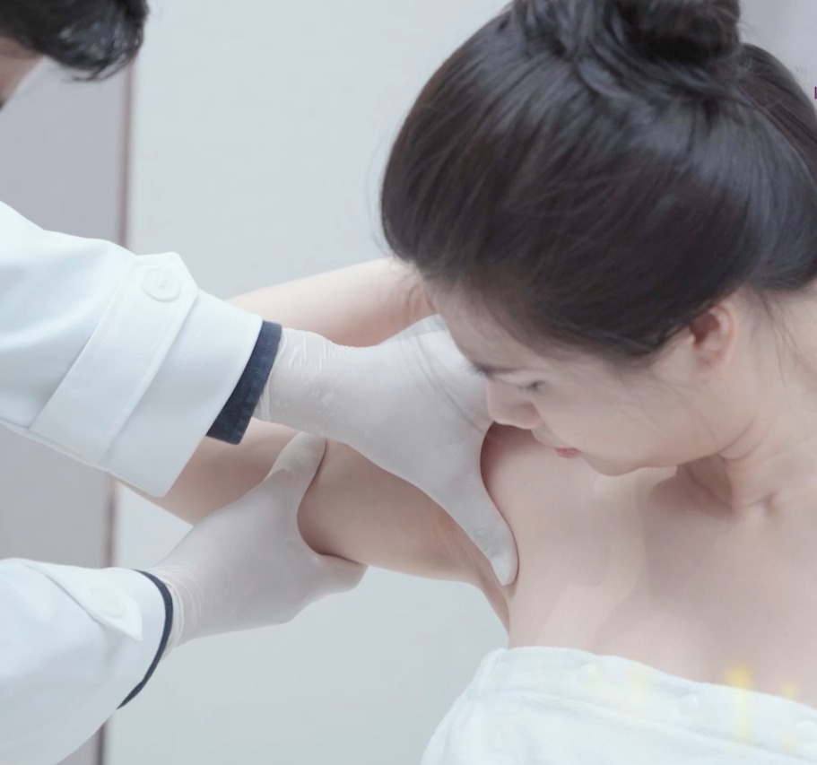 hình ảnh triệt lông nách