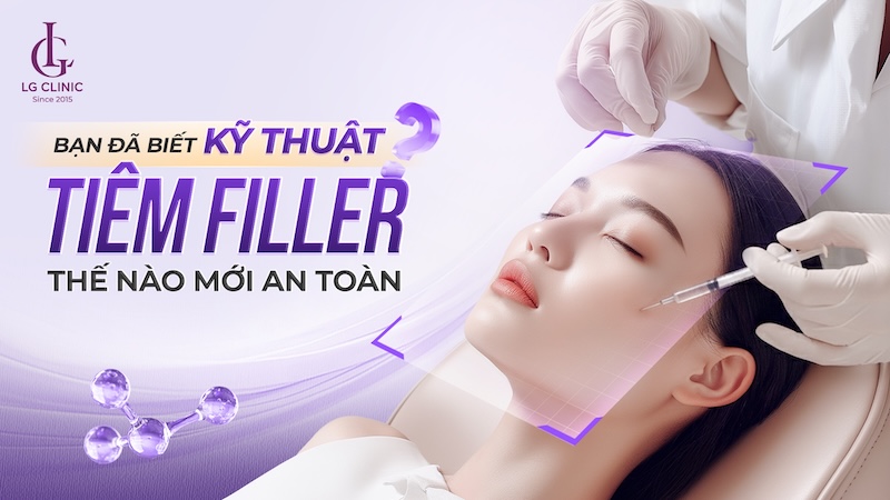 kỹ thuật tiêm filler