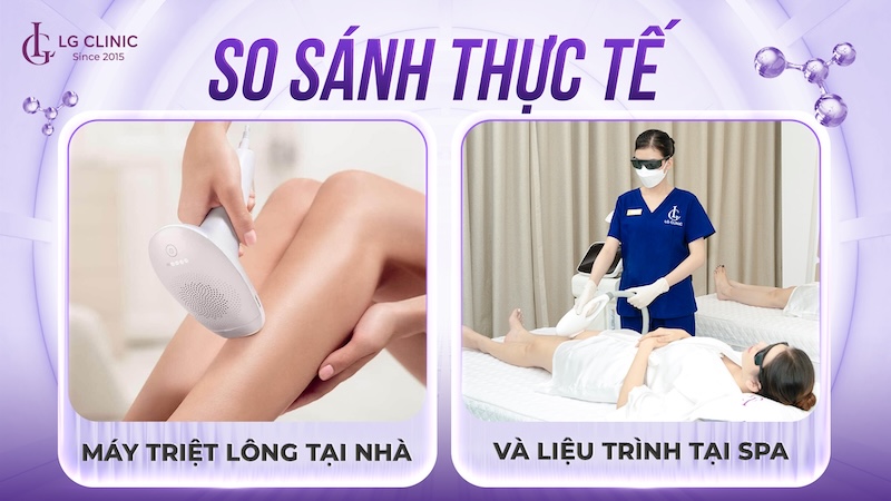 nên mua máy triệt lông hay đi spa