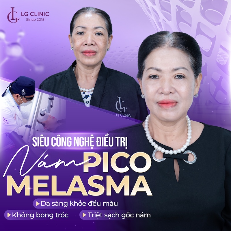 trị nám pico melasma