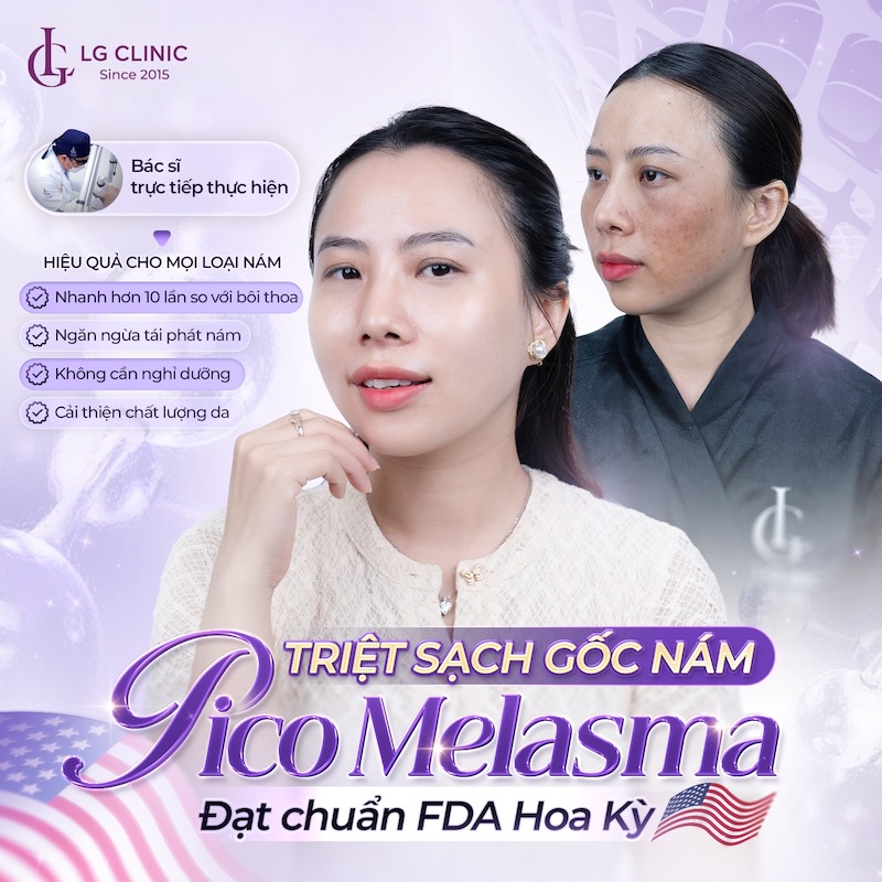 trị nám pico melasma