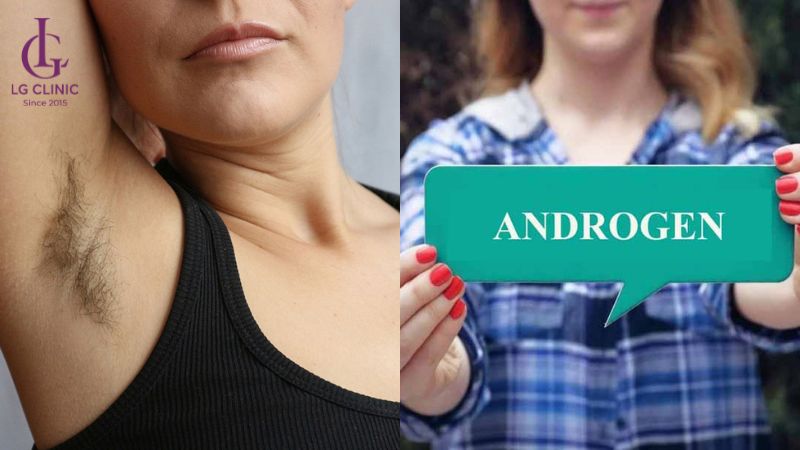 tại sao lông nách mọc nhiều ở nữ