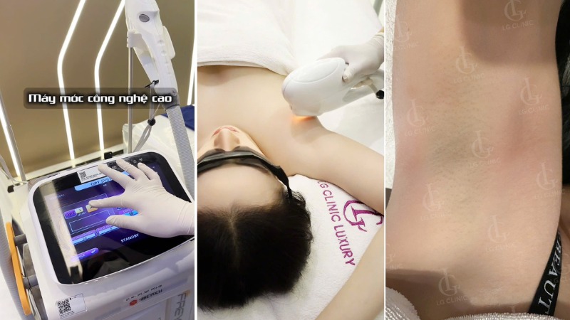 tại sao lông nách mọc nhiều ở nữ