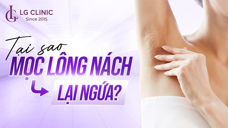 Tại sao mọc lông nách lại ngứa
