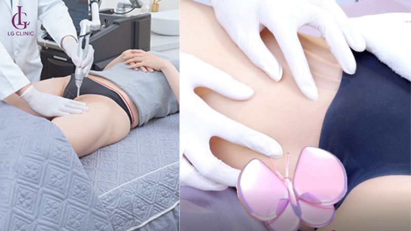 thâm bẹn sau sinh có tự hết không