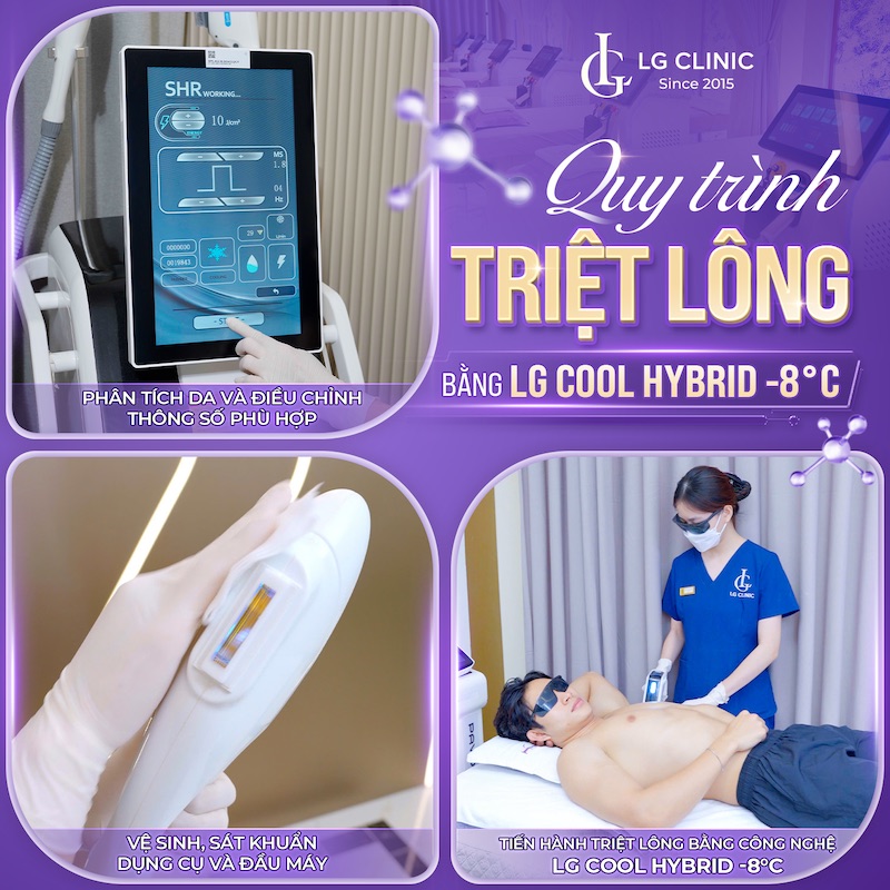 Quy trình triệt lông