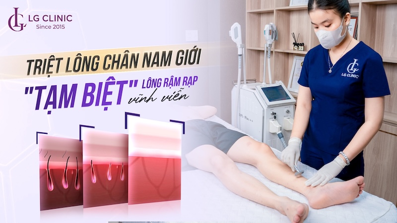 triệt lông chân cho nam giới