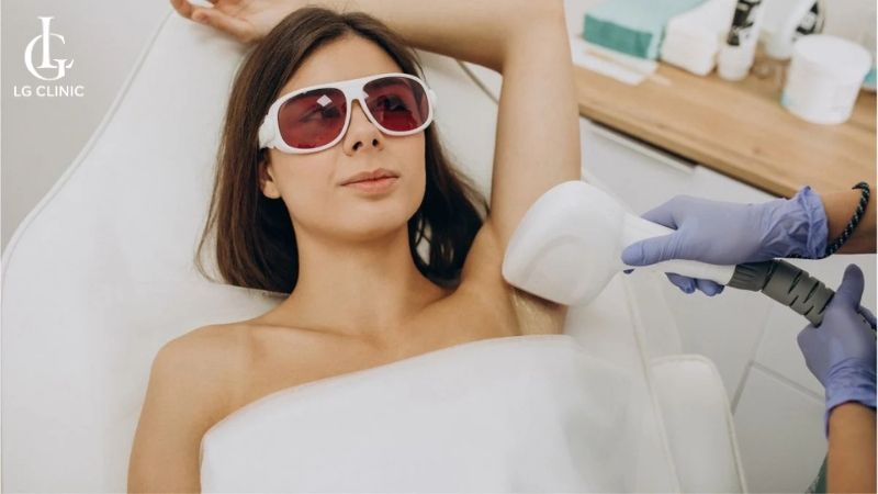 triệt lông nách bằng công nghệ diode laser