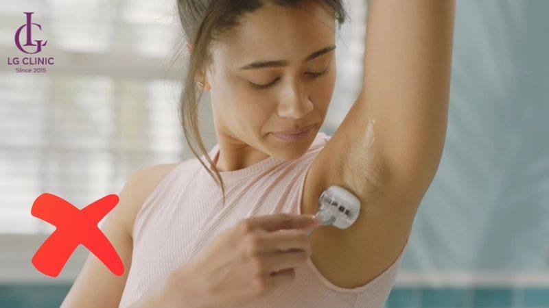 triệt lông nách bằng công nghệ diode laser