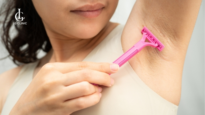 Triệt lông nách bao nhiêu phút