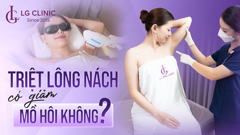 Triệt lông nách có giảm mồ hôi không