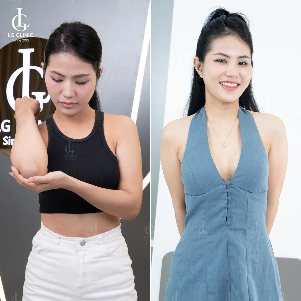 Hình ảnh BA tắm trắng