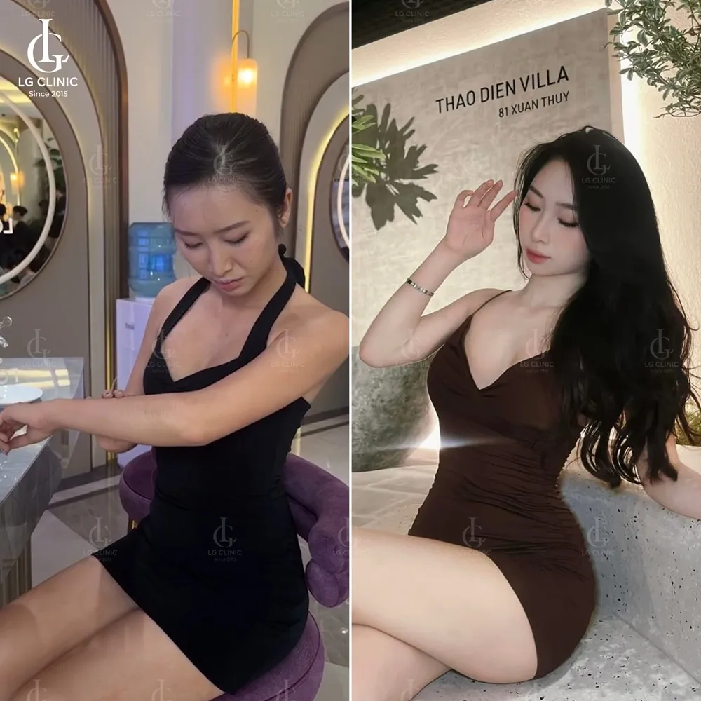 Hình ảnh BA tắm trắng