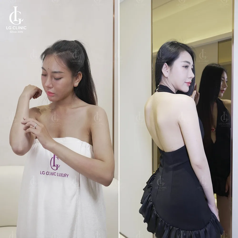 Hình ảnh BA tắm trắng