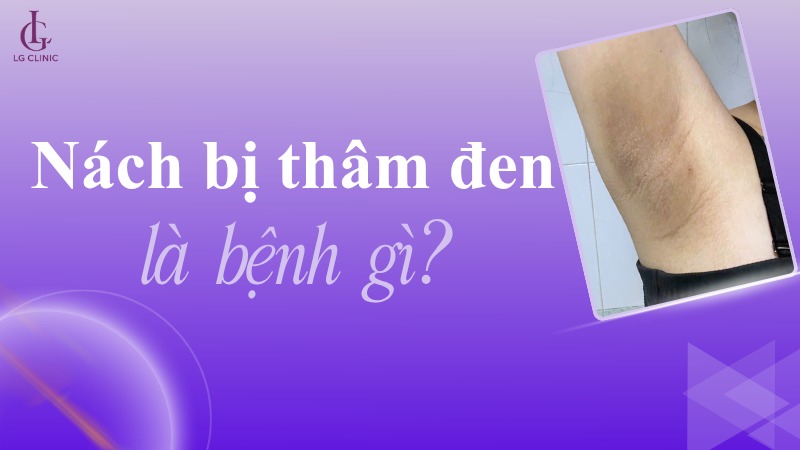 nách bị thâm đen là bệnh gì