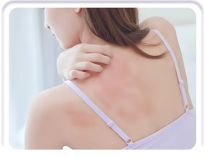 Người sợ tẩy trắng