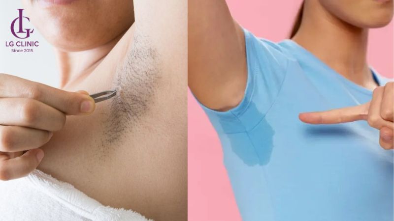 nhổ lông nách có bị hôi nách không