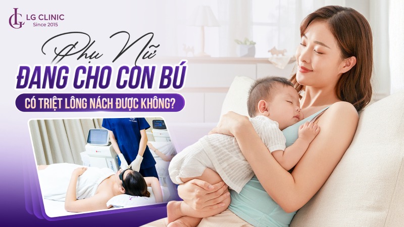 Phụ nữ đang cho con bú có triệt lông nách được không
