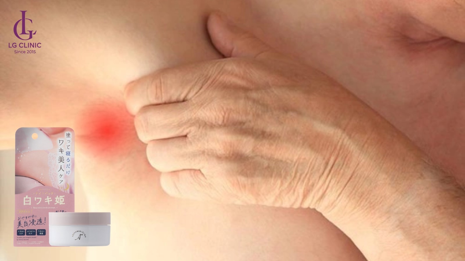 tại sao mọc lông nách lại ngứa