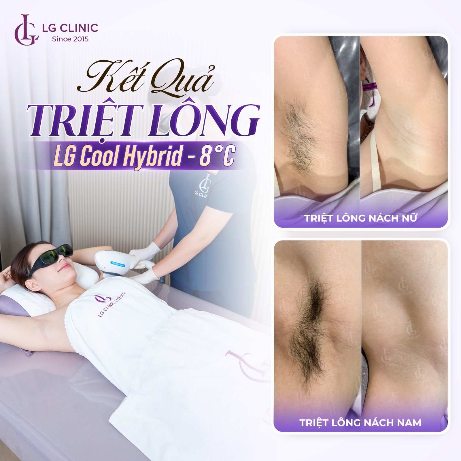 tai-sao-moc-long-nach-lai-ngua-1