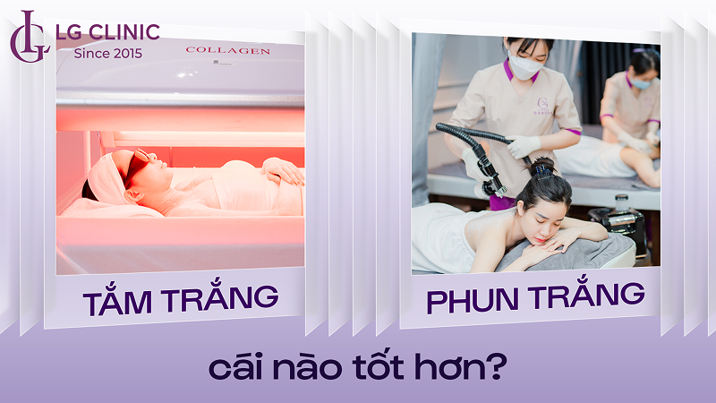 Tắm trắng và phun trắng cái nào tốt hơn