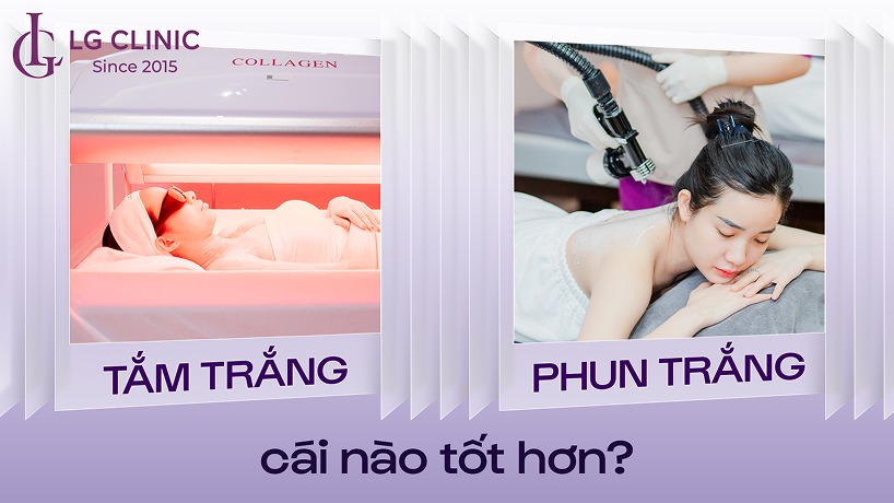 Tắm trắng và phun trắng cái nào tốt hơn