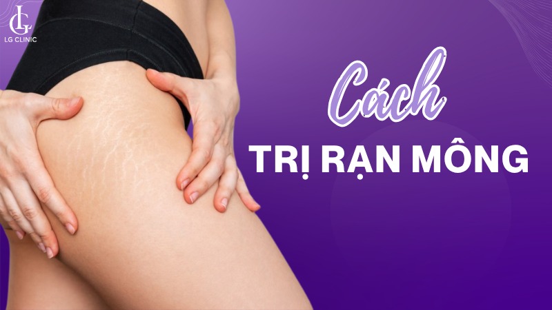 trị rạn mông