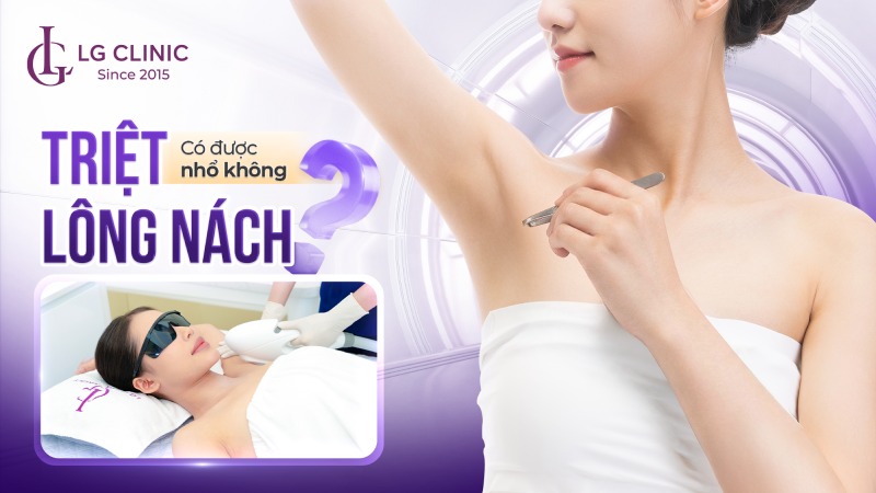 Triệt lông nách có được nhổ không