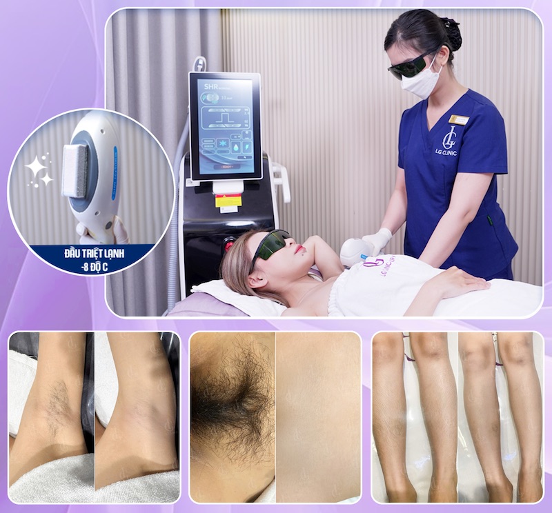 Công nghệ LG Cool Hybrid