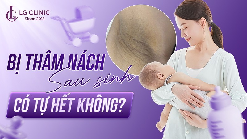 Thâm nách sau sinh có tự hết không