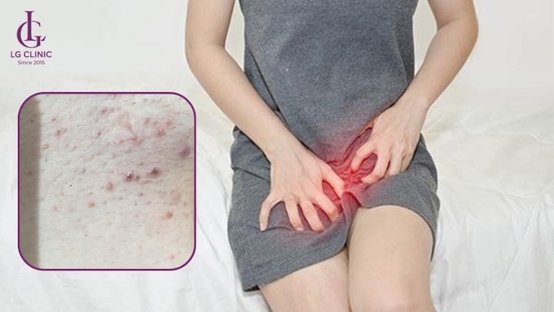 nổi mụn vì không vệ sinh đúng cách