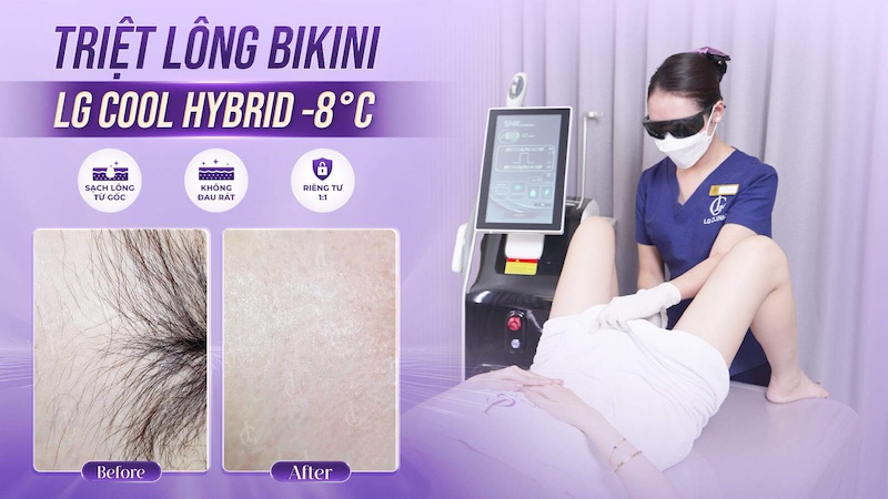 triệt lông vùng kín để tránh nổi mụn