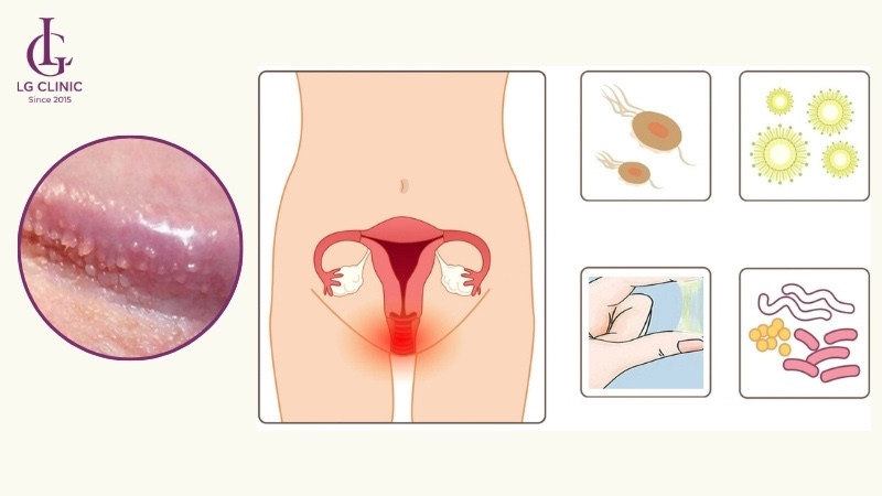 nổi mụn trắng li ti