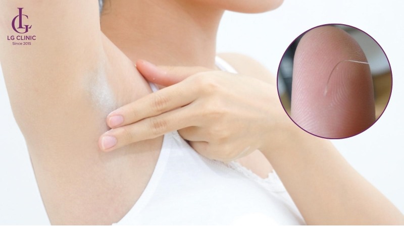 lông nách bị bạc trắng