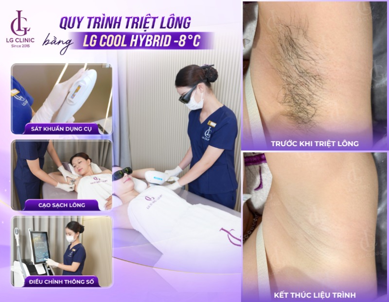 lông nách bị bạc trắng