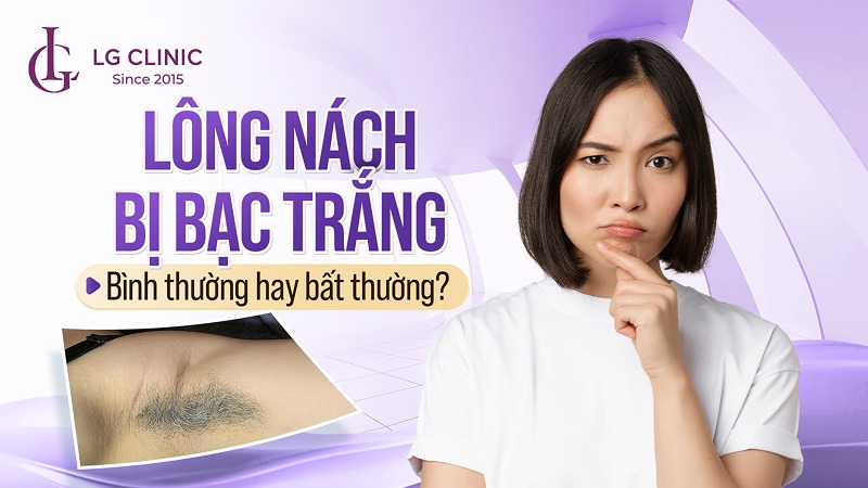 lông nách bị bạc trắng