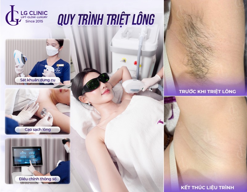 nguyên nhân lông nách bị bạc trắng